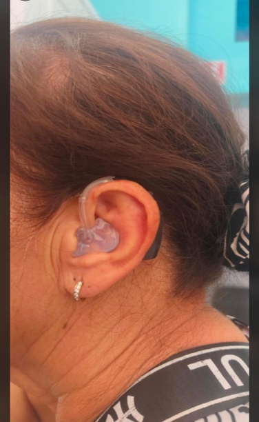BTE Behind-the-Ear colocado